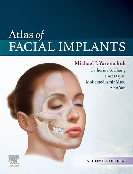 Portada del libro: Atlas de Implantes Faciales