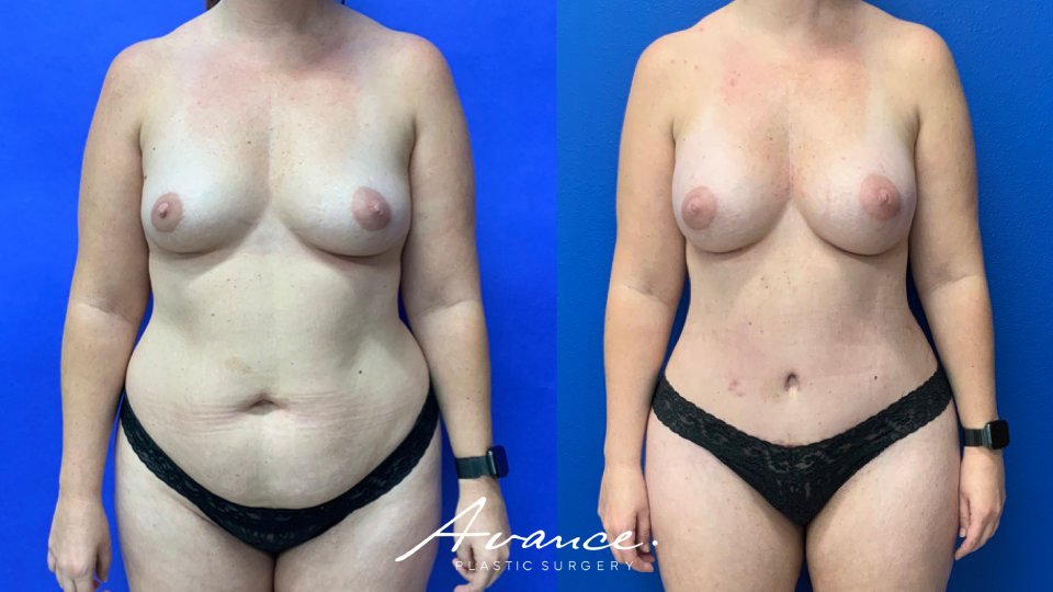 Before and After - Cambio de imagen para mamás