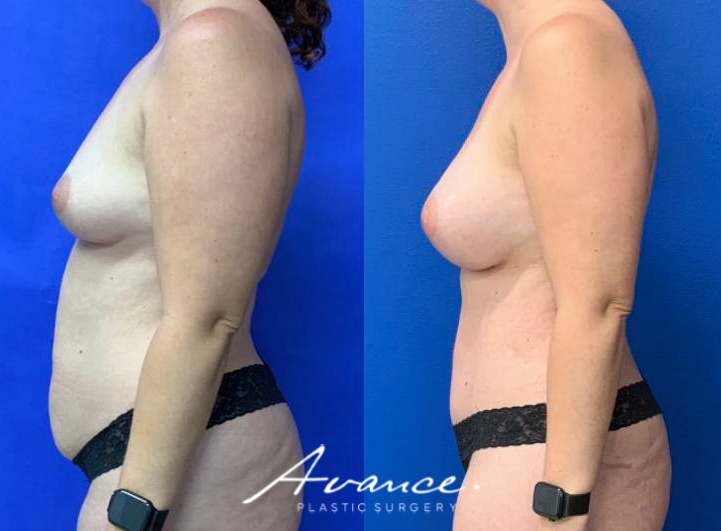 Before and After - Cambio de imagen para mamás