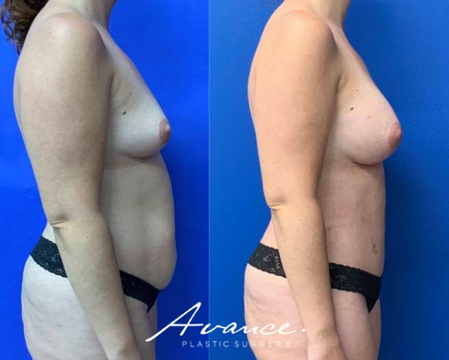 Before and After - Cambio de imagen para mamás