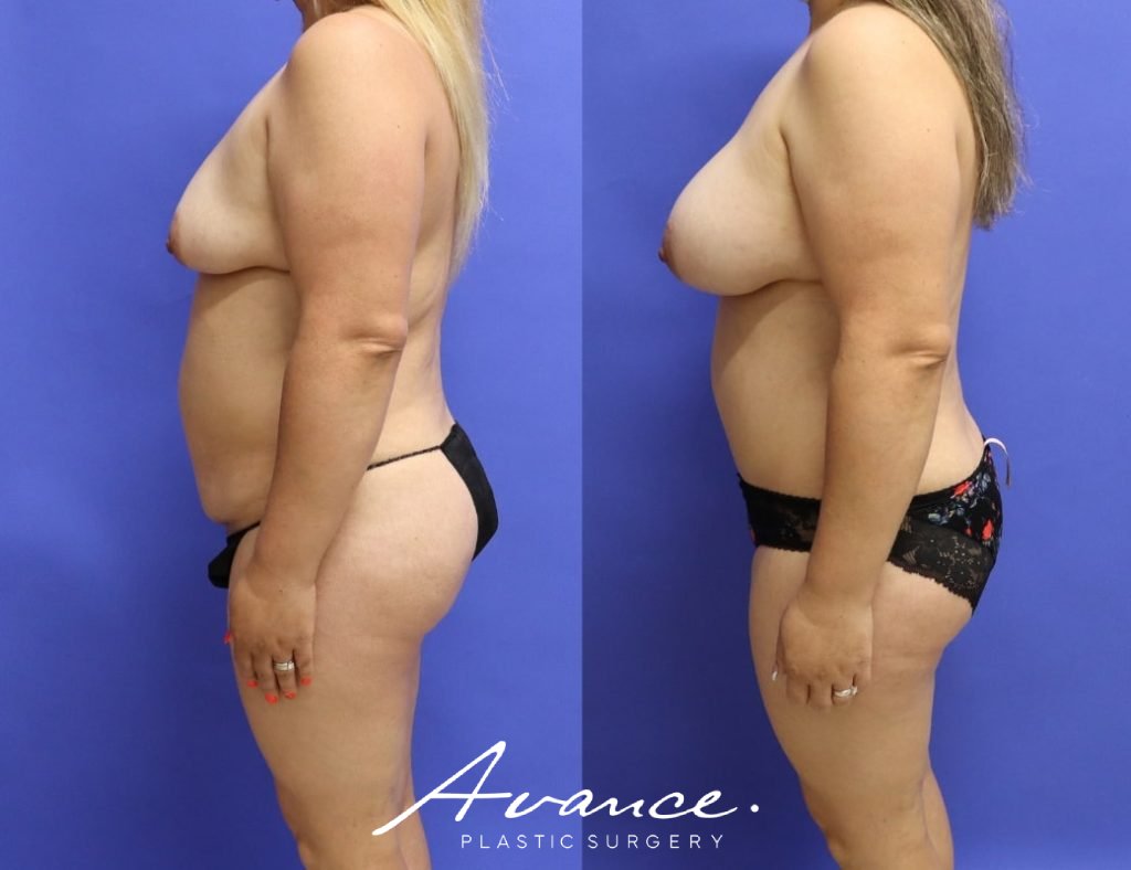 Before and After - Cambio de imagen para mamás