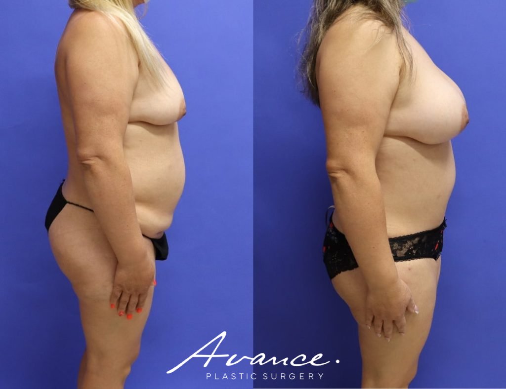 Before and After - Cambio de imagen para mamás