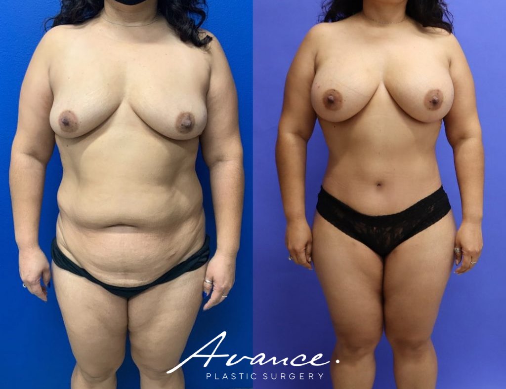 Before and After - Cambio de imagen para mamás