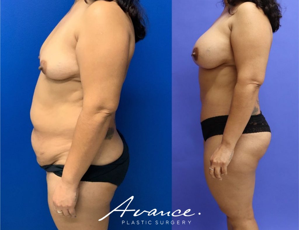 Before and After - Cambio de imagen para mamás