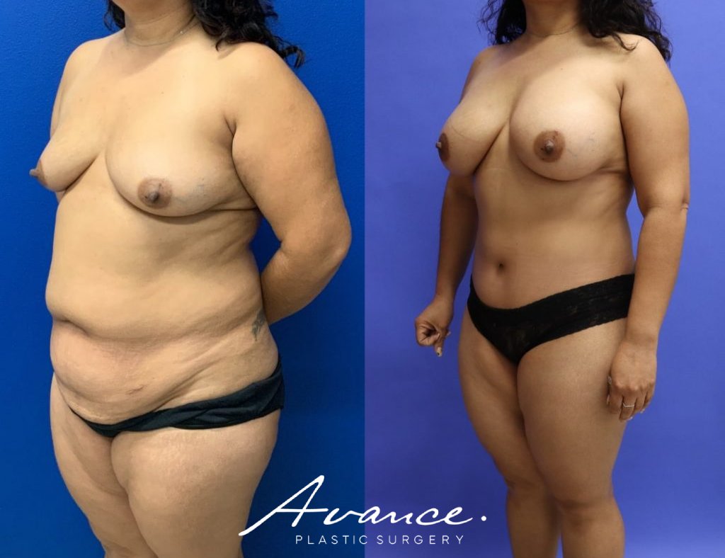 Before and After - Cambio de imagen para mamás