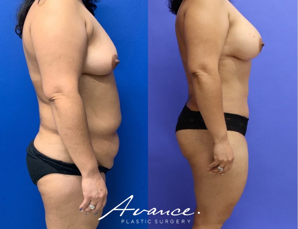 Before and After - Cambio de imagen para mamás