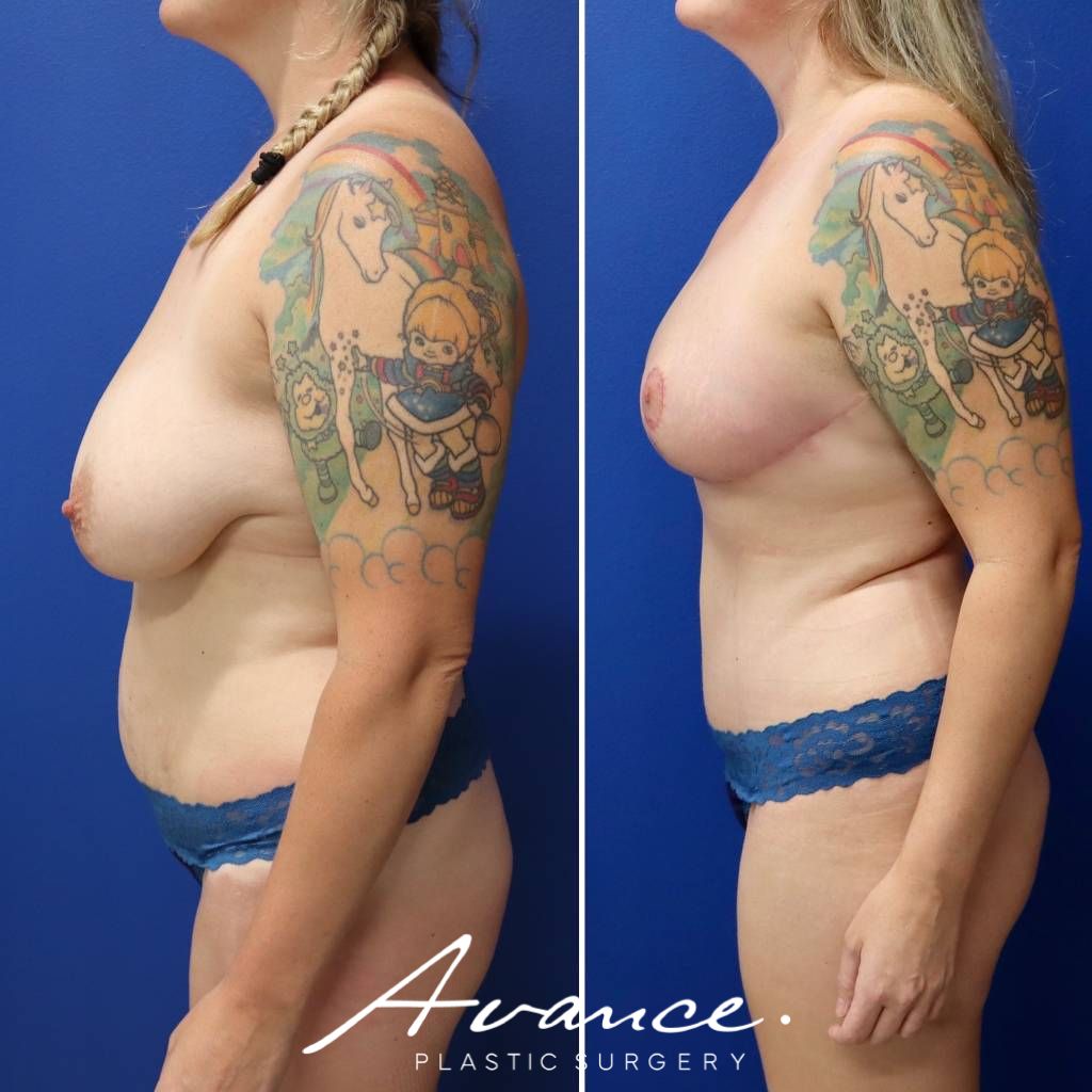 Before and After - Cambio de imagen para mamás