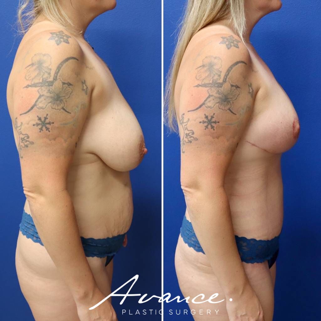 Before and After - Cambio de imagen para mamás