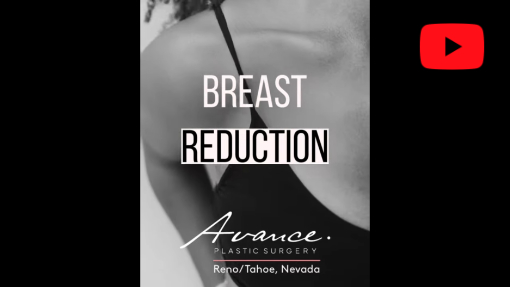 YouTube video titled Breast Reduction Dr. Erez Dayan Avance Plastic Surgery